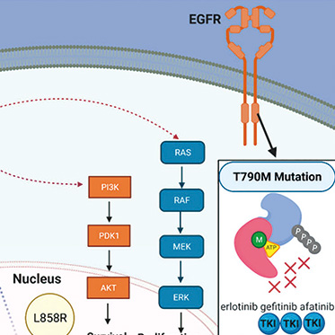EGFR变异的NSCLC 吉非替尼联合化疗有持久的生存获益